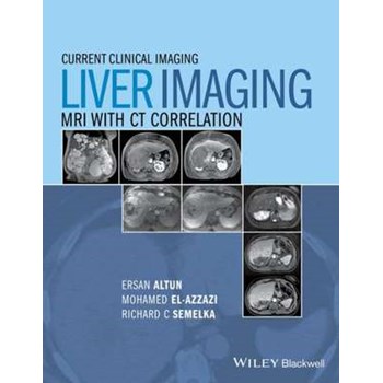 Liver Imaging
