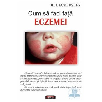 Cum sa faci fata eczemei - Jill Eckersley