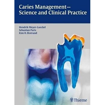 Caries Management - Science and Clinical Practice