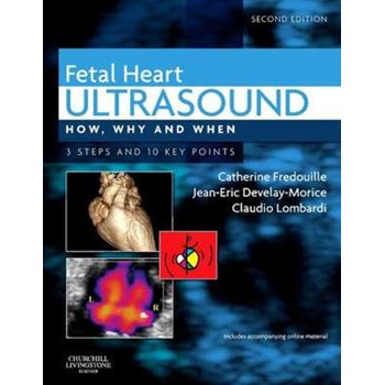 Fetal Heart Ultrasound: How, Why and When (How, Why and When)
