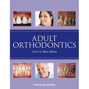 Adult Orthodontics